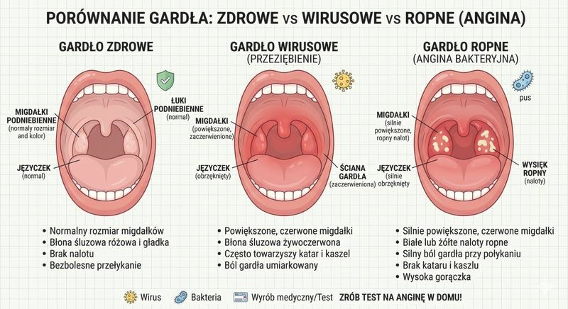 Ile dni L4 na anginę ropną? Typowy czas zwolnienia lekarskiego